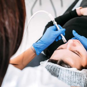 What is Microdermabrasion?